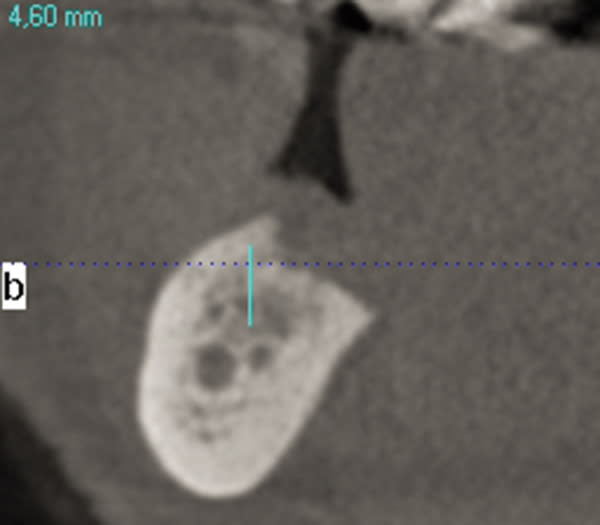 Figure 17