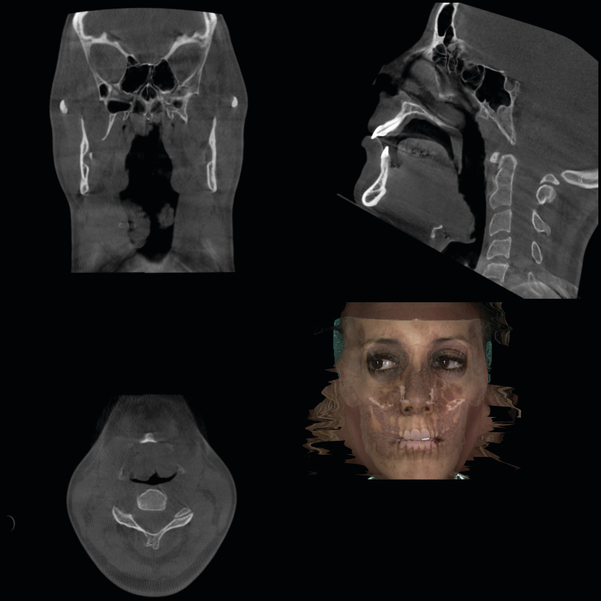 Figure 30