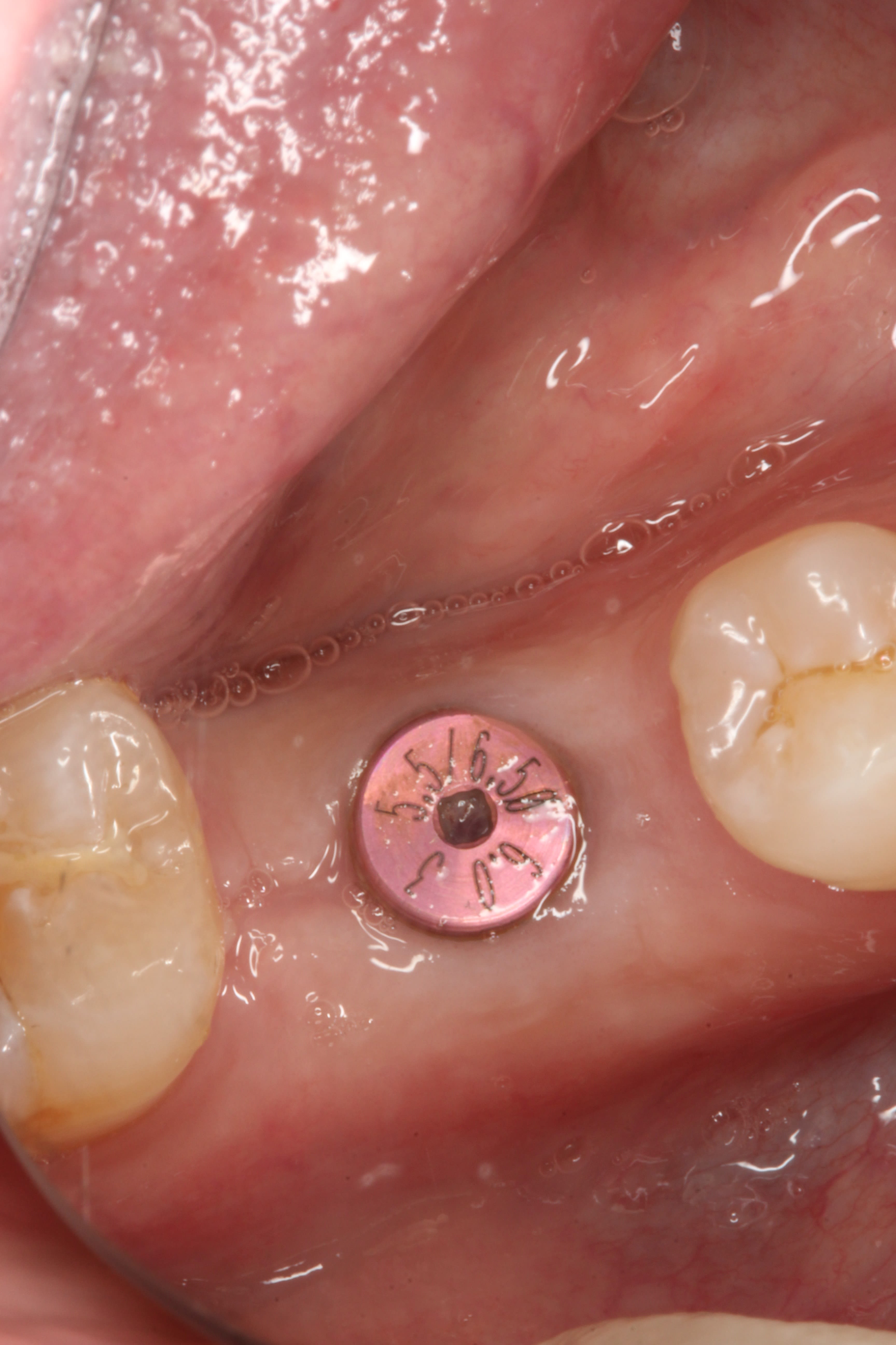 Figure 45