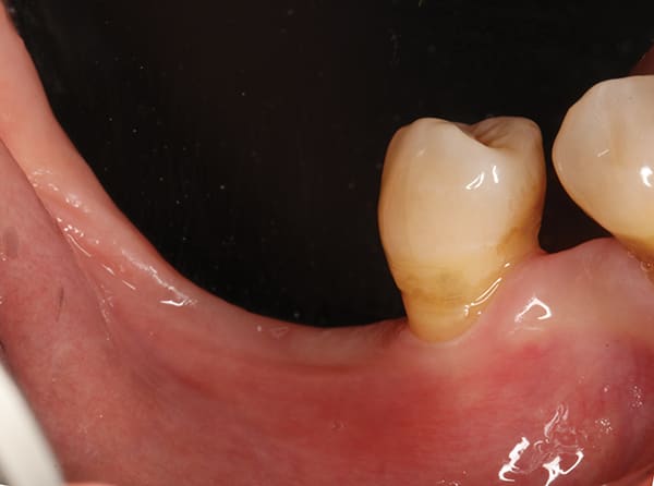Figure 16
