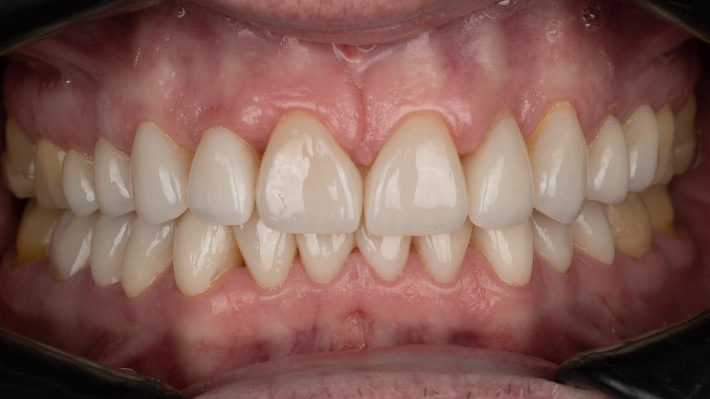 Figure 17