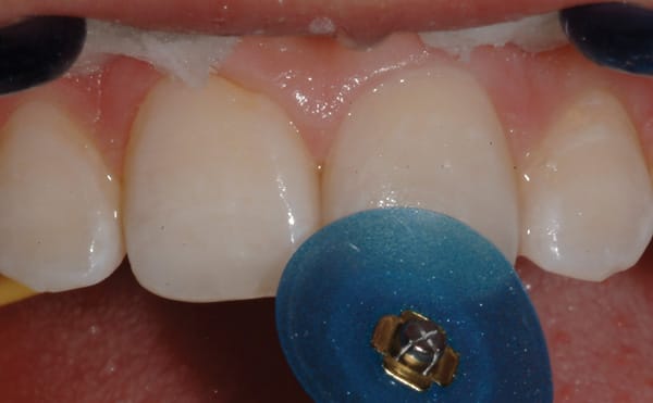 Figure 18