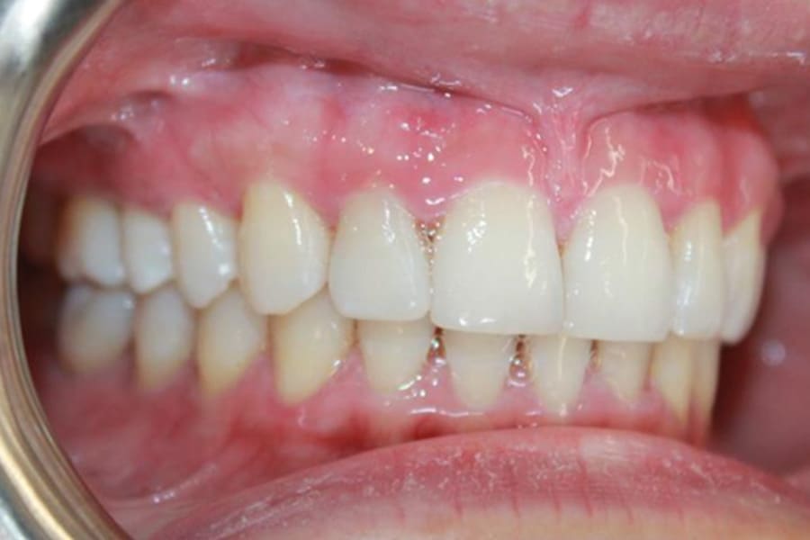 Figure 10