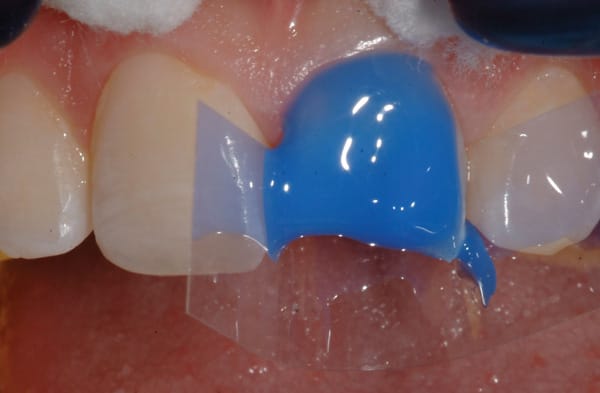 Figure 11