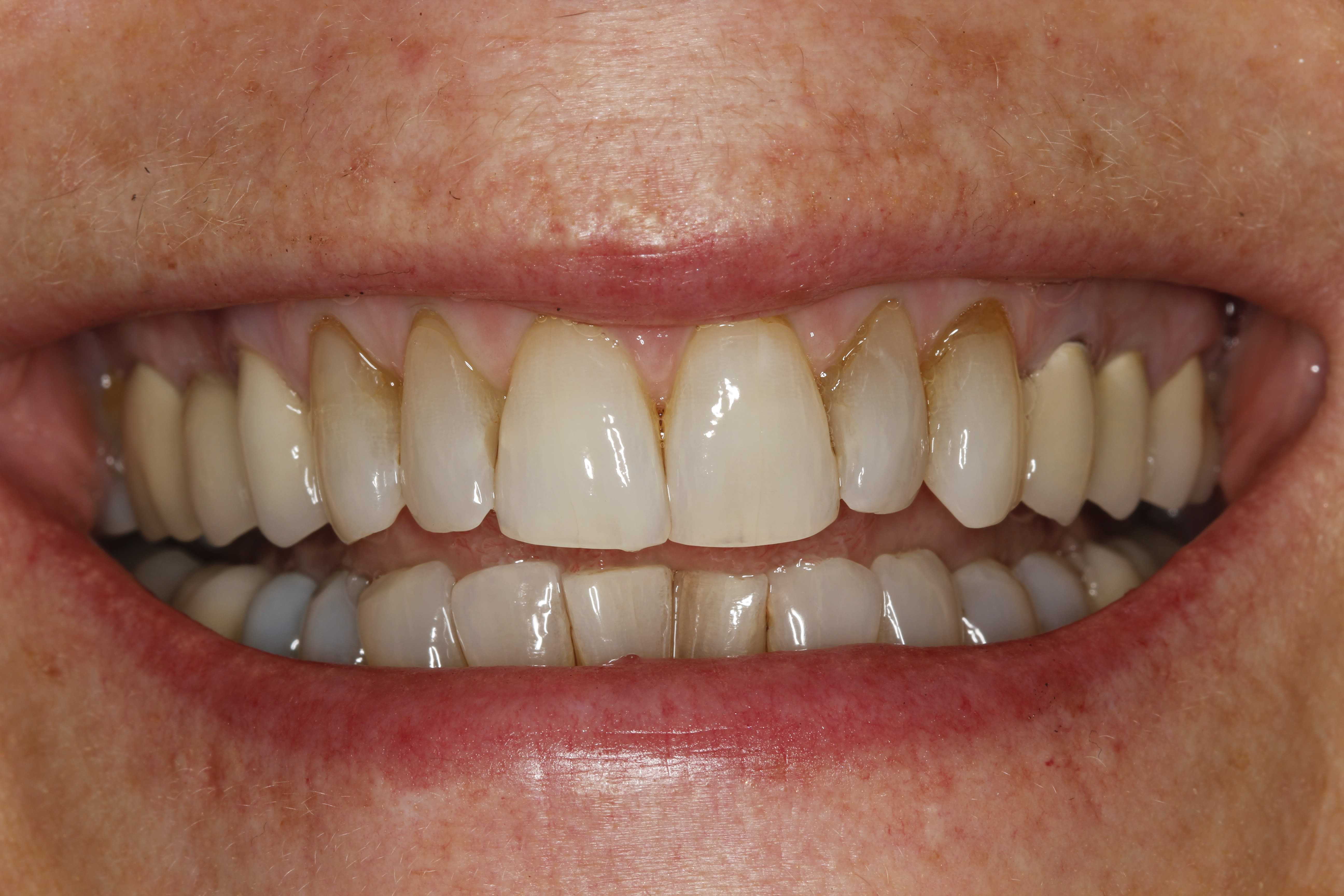 Figure 38