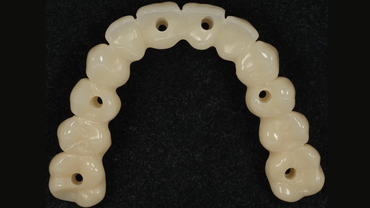 Figure 18