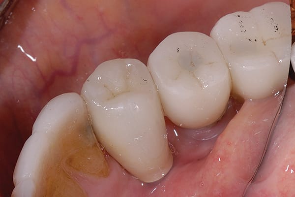Figure 17