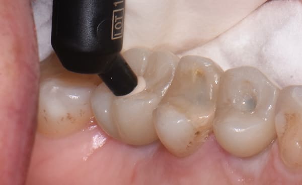 Figure 10