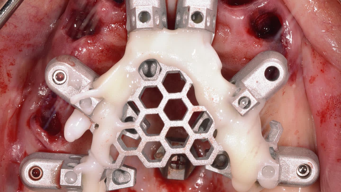Figure 12