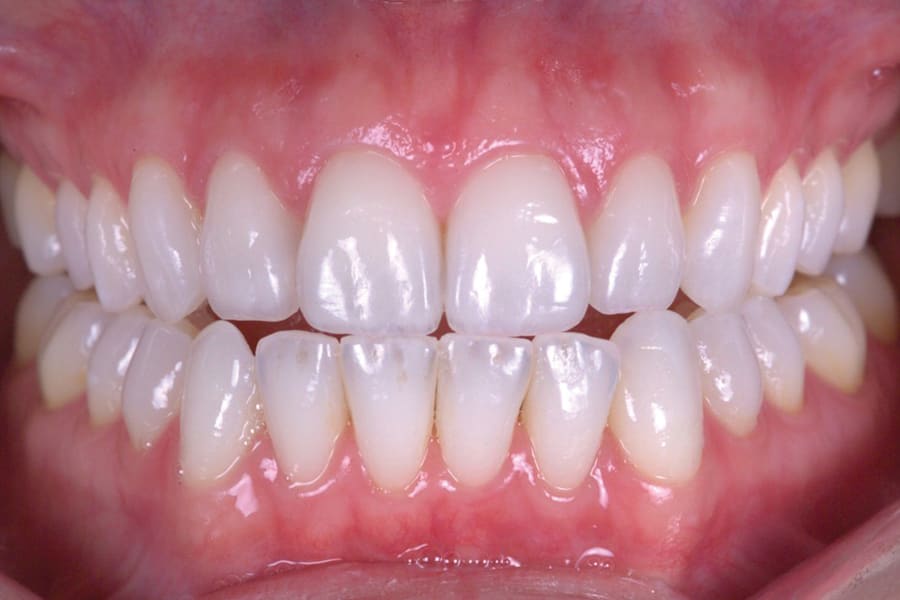 Figure 13
