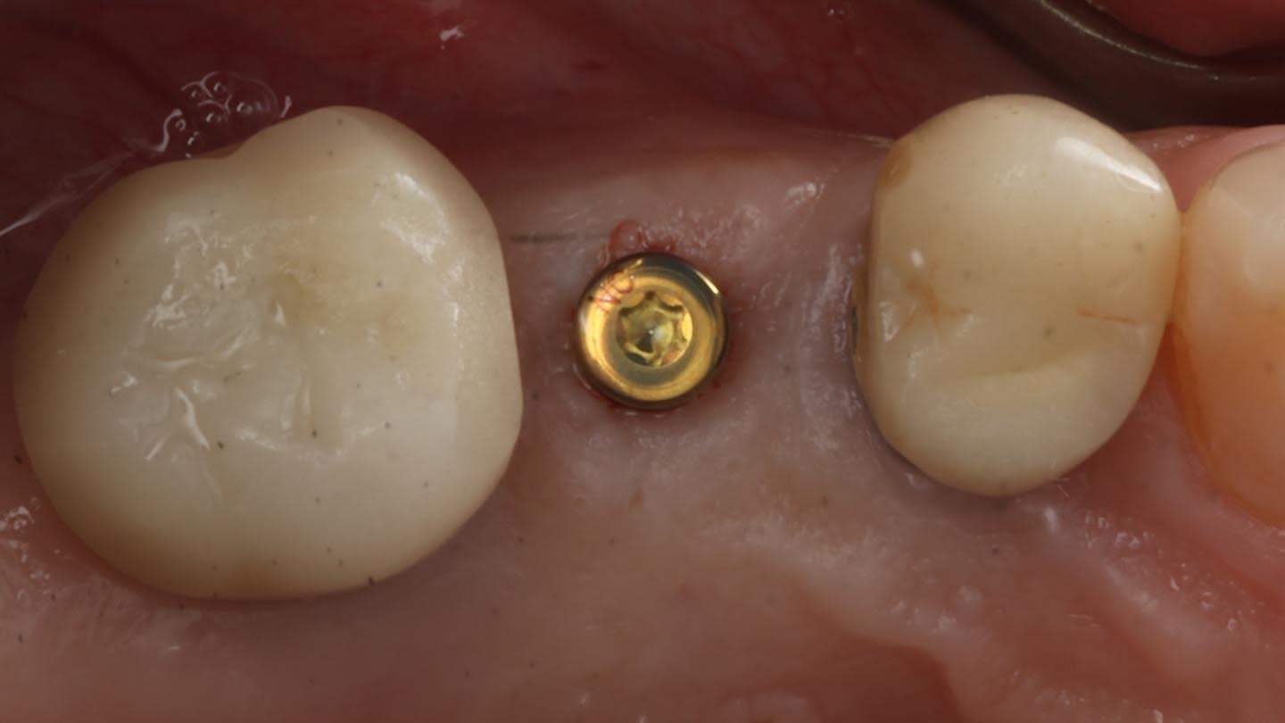 Figure 22