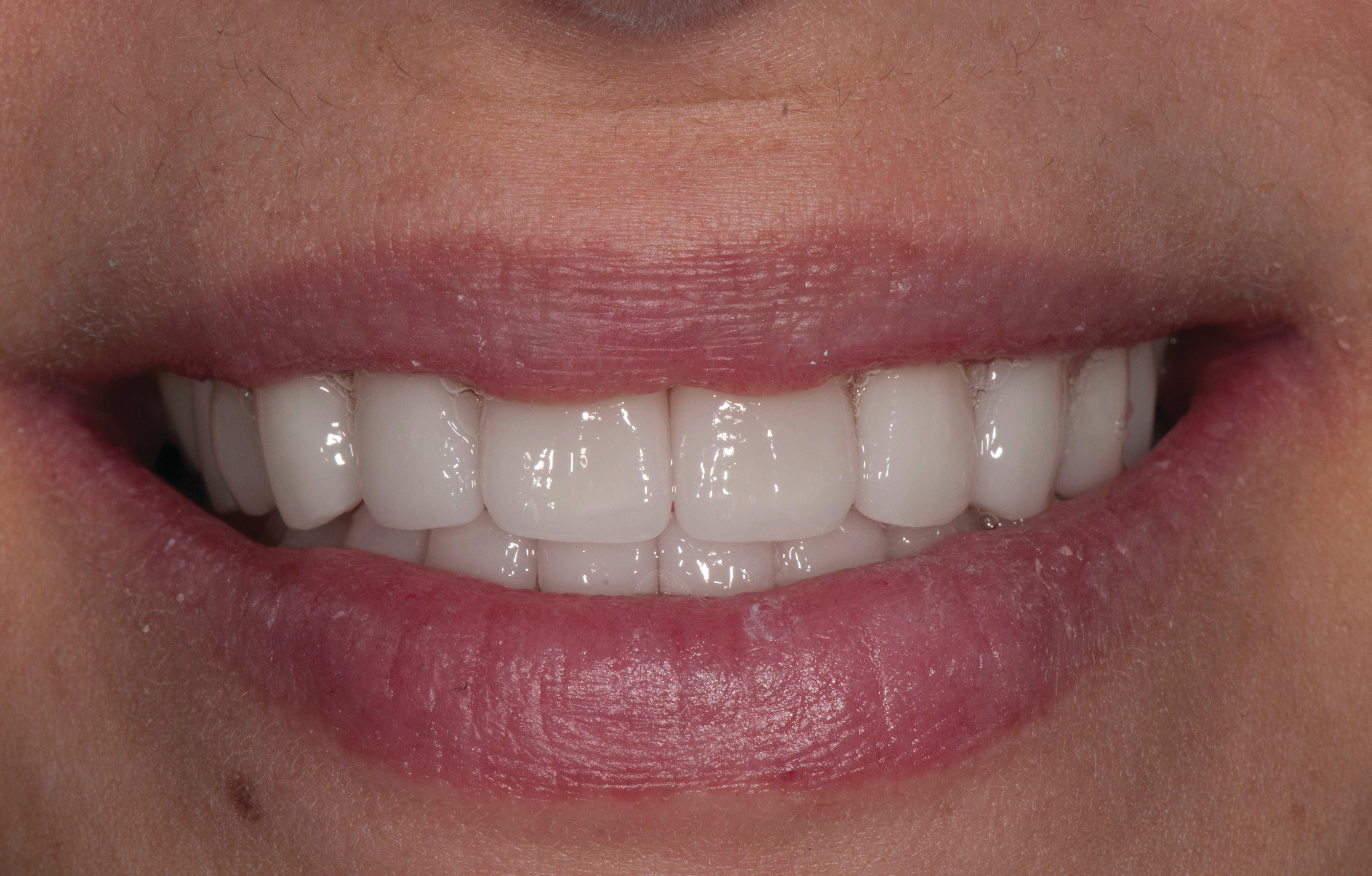 Figure 15