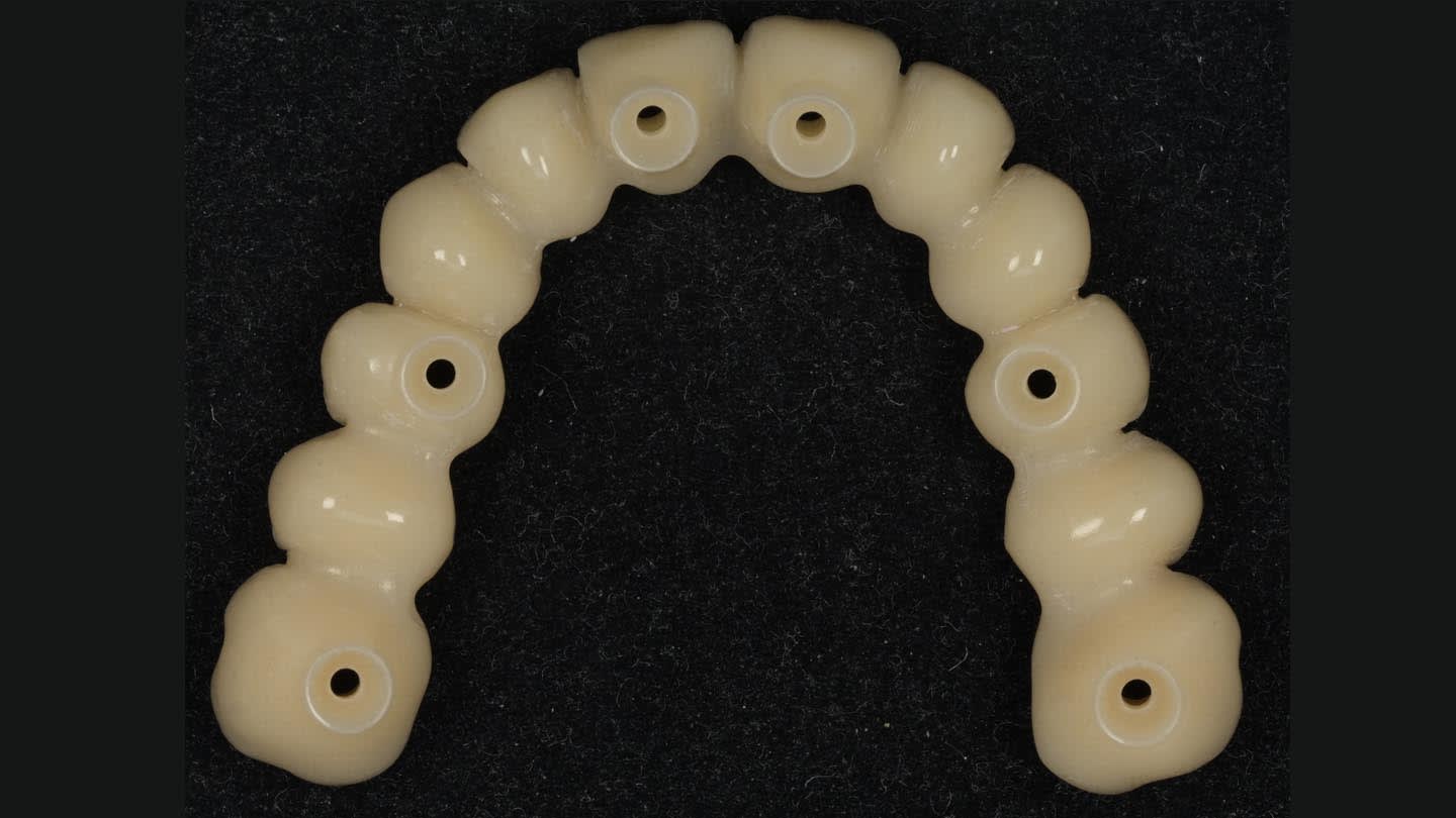 Figure 17