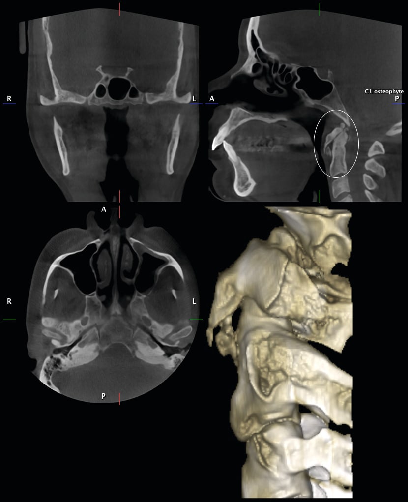 Figure 41
