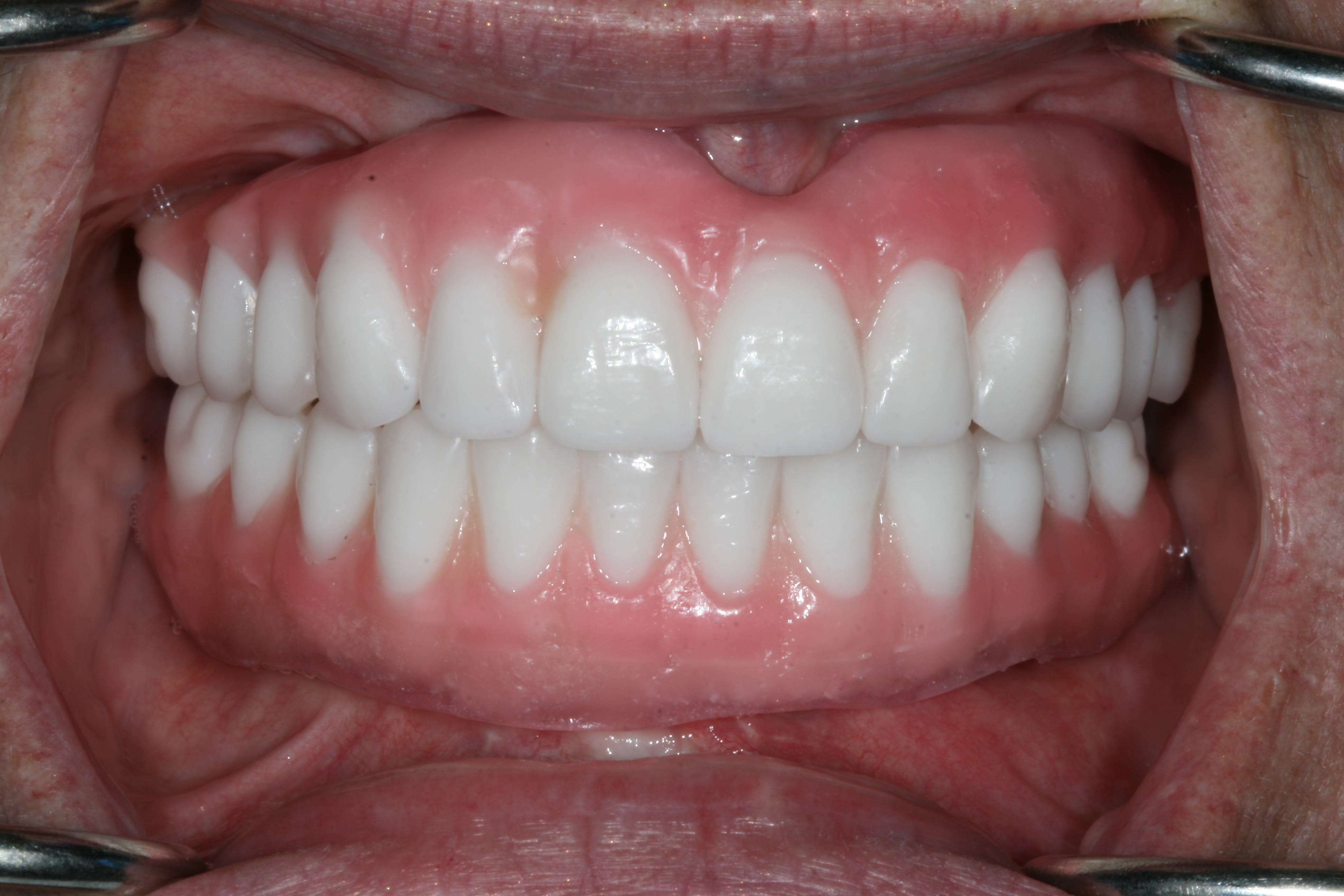 Figure 14