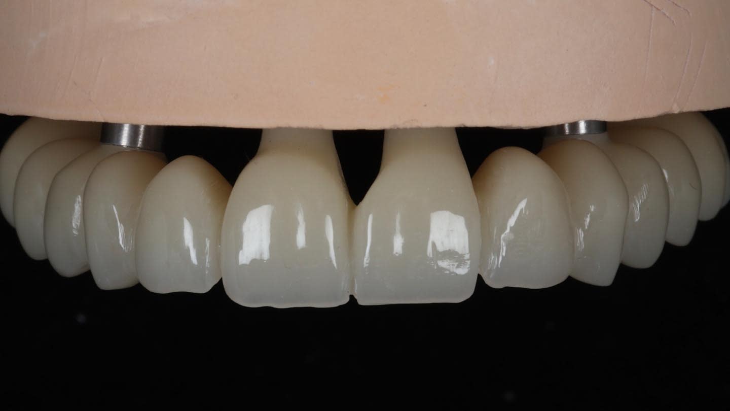 Figure 16