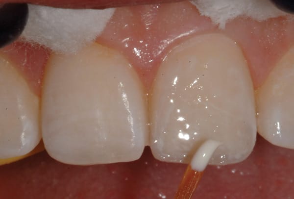 Figure 15