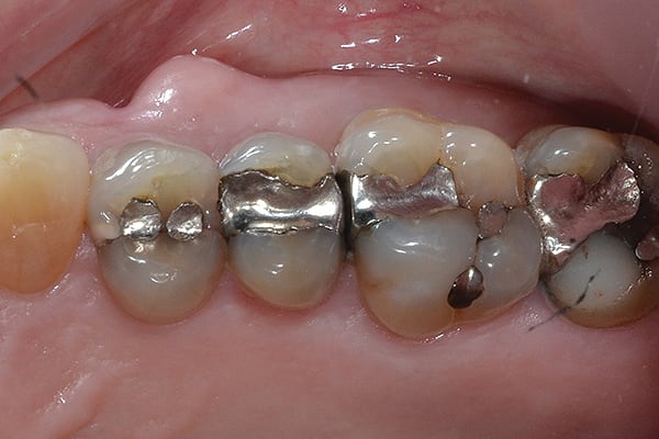 Figure 11