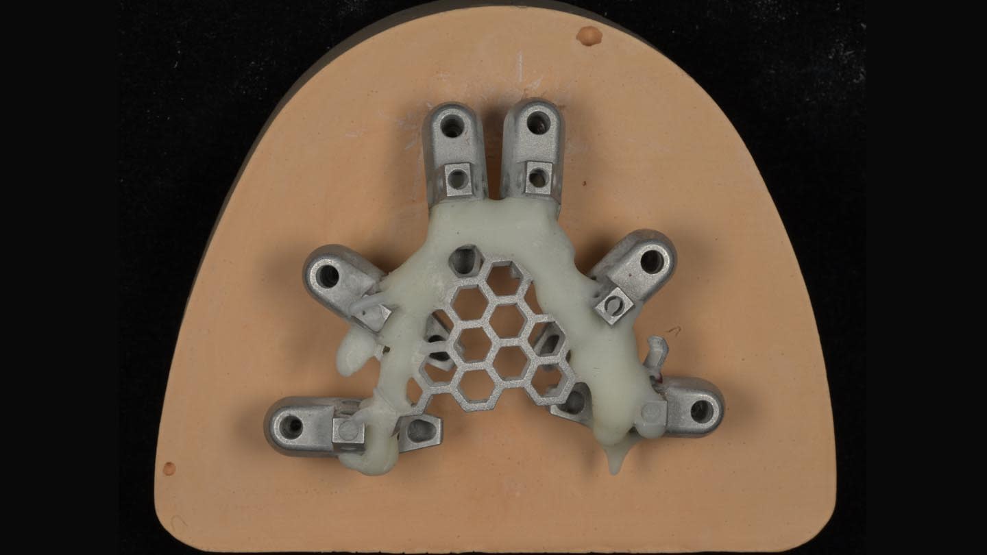 Figure 15