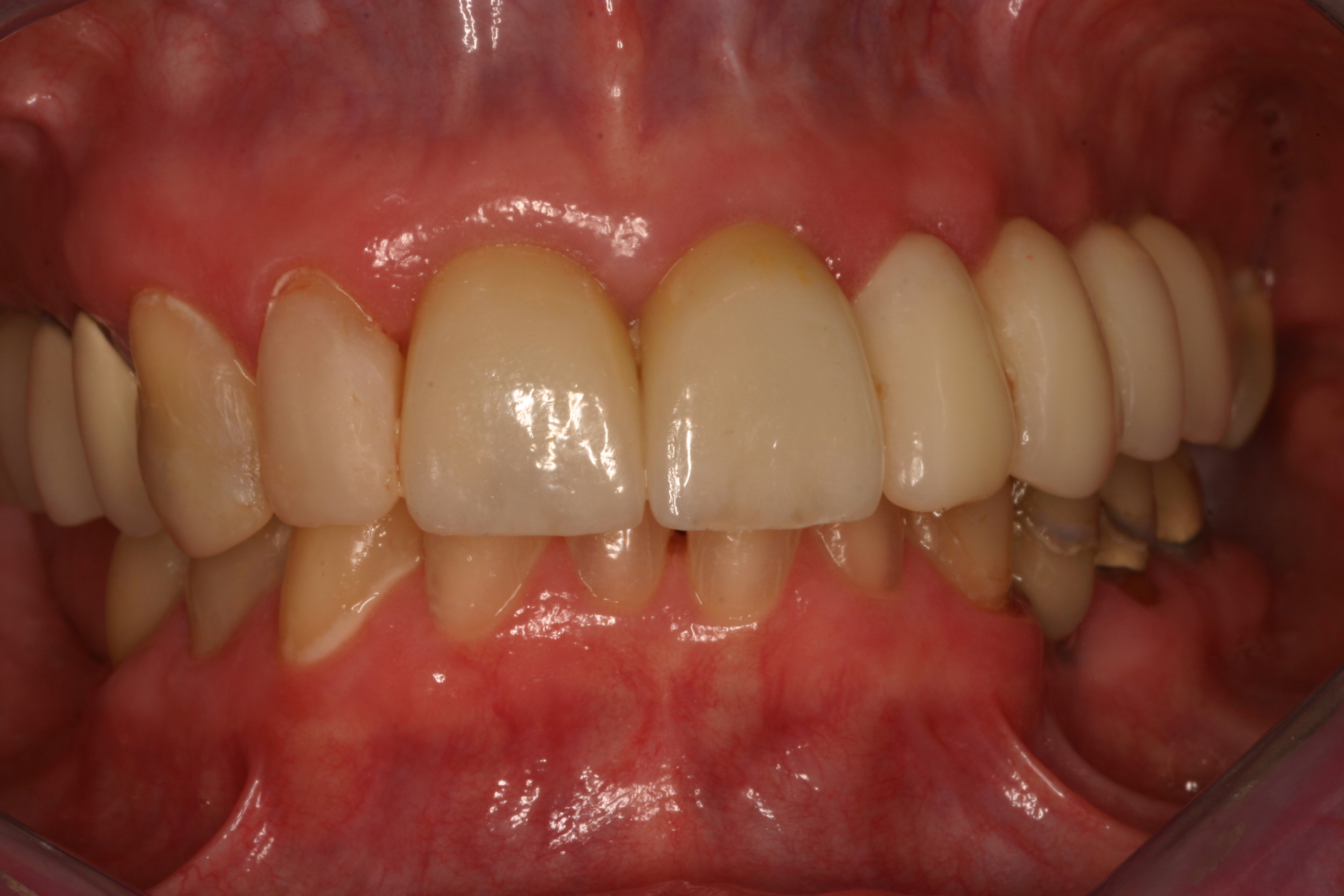 Figure 27