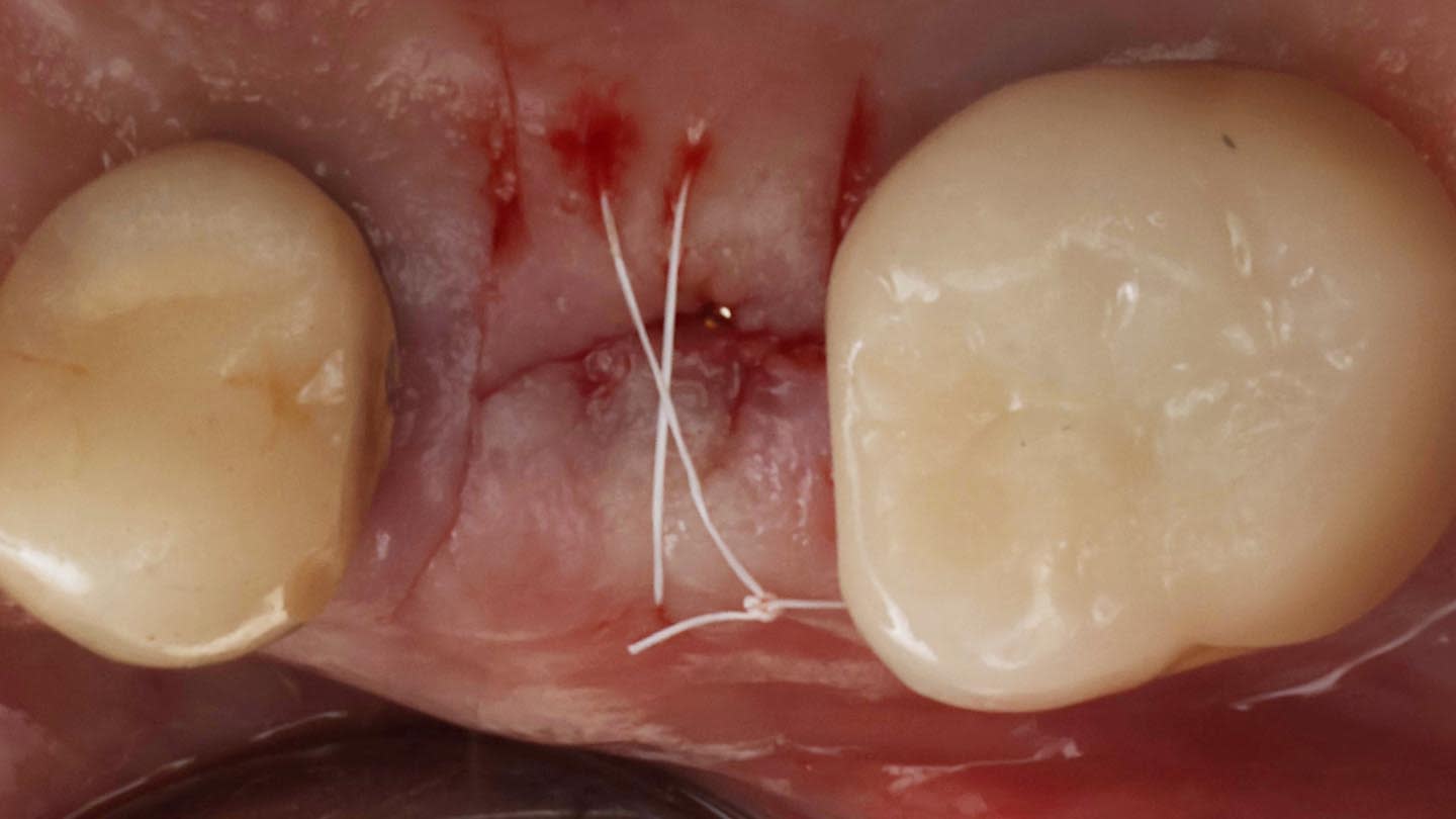 Figure 18