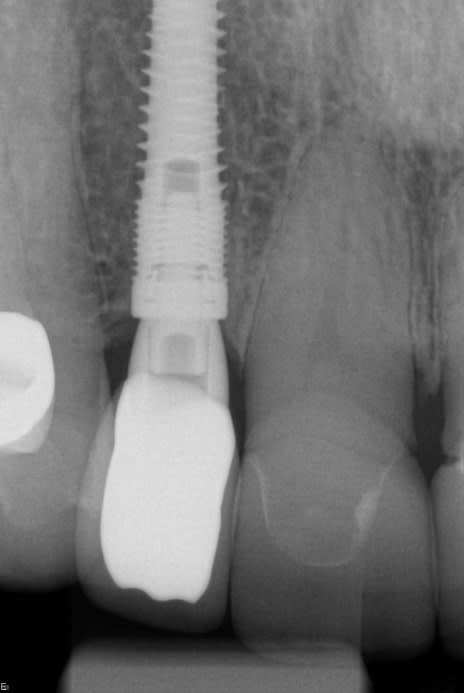 Figure 18