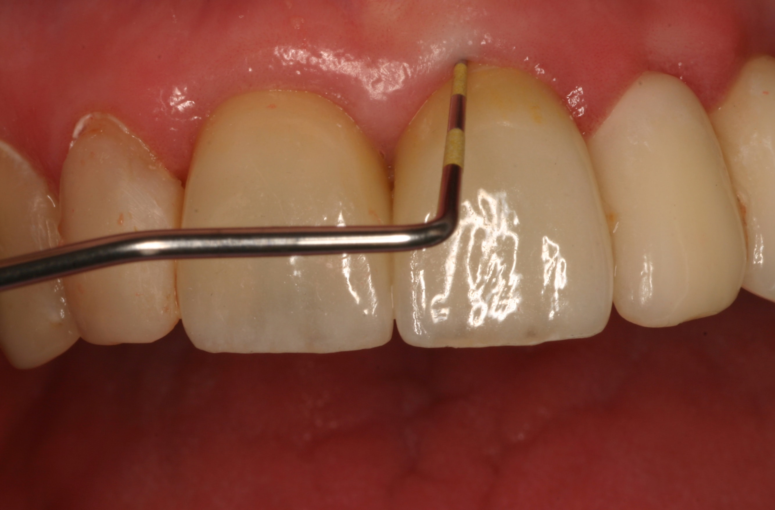 Figure 26