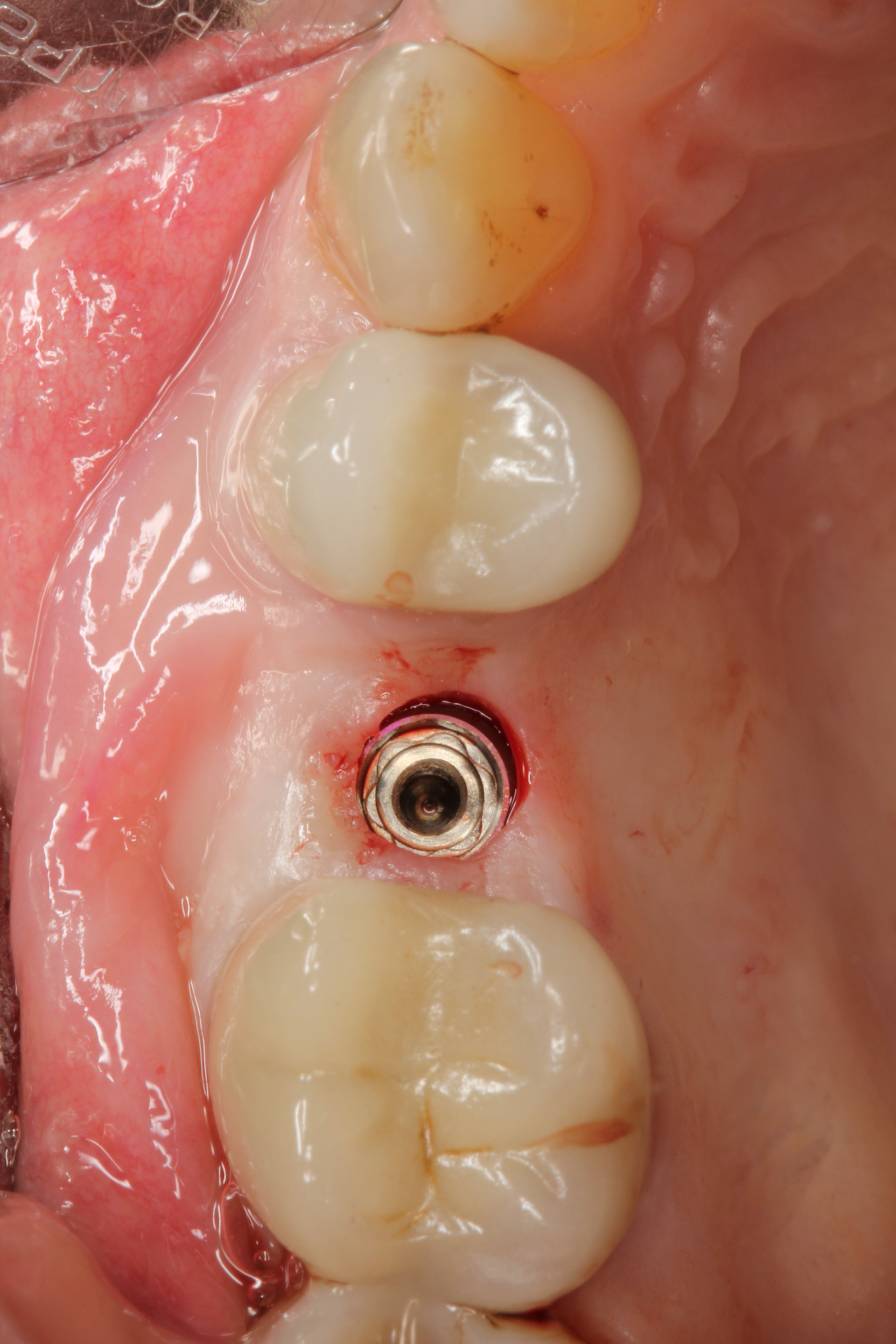 Figure 32