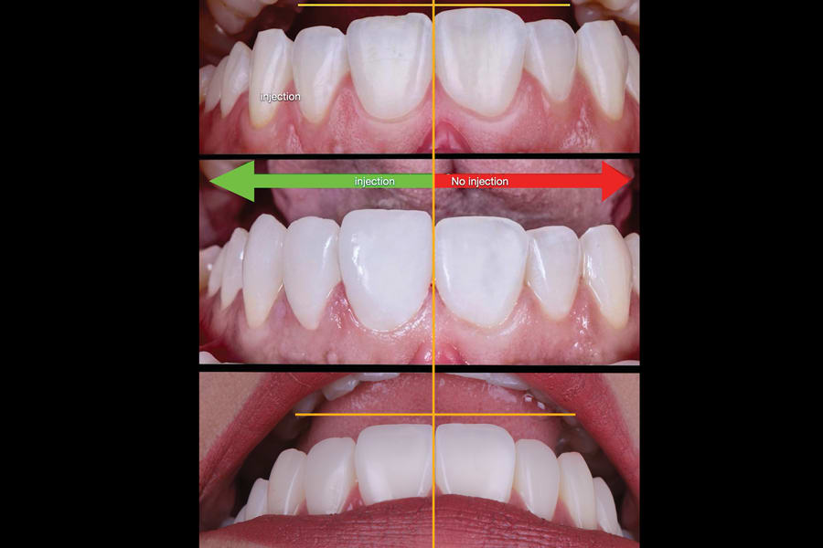 Figure 12