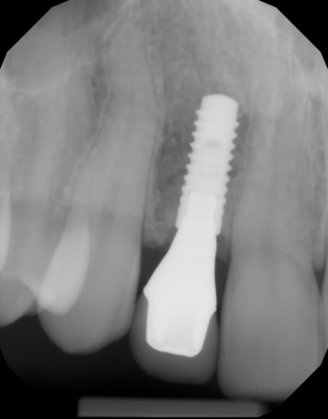 Figure 28