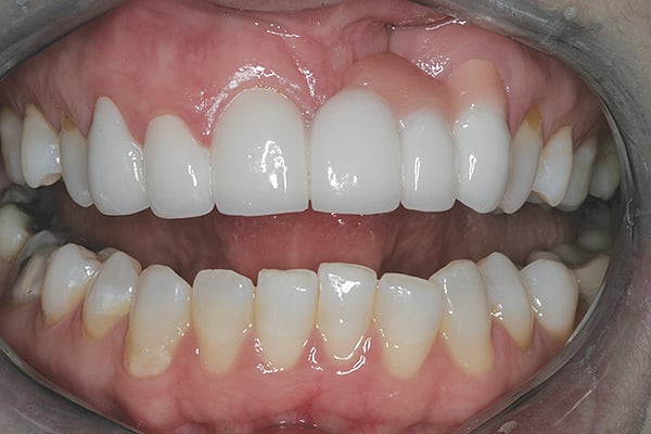 Figure 11