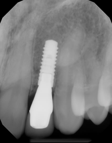 Figure 29