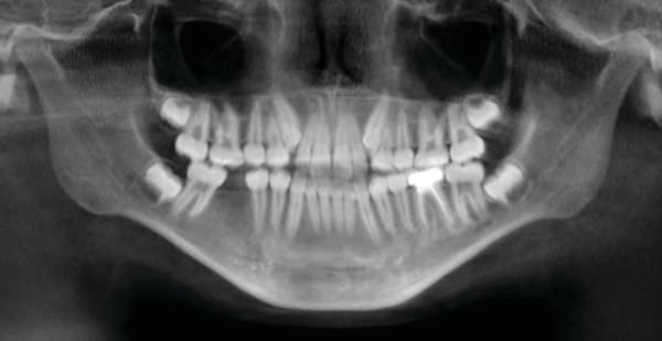 Figure 10