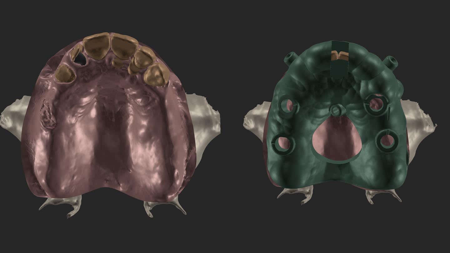 Figure 6A