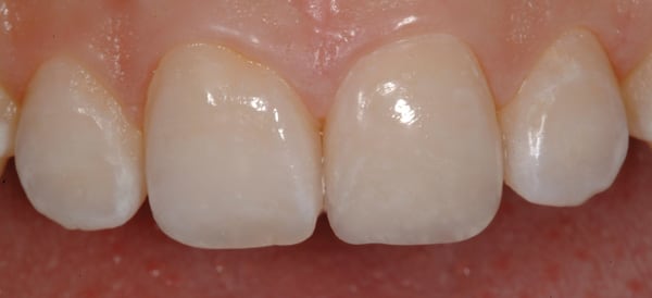 Figure 20