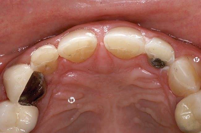 Figure 11b