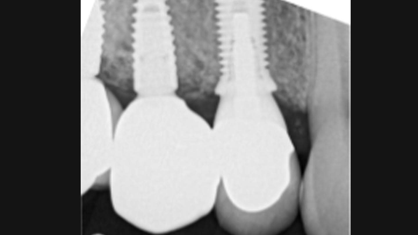 Figure 26