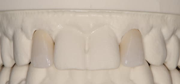Figure 25