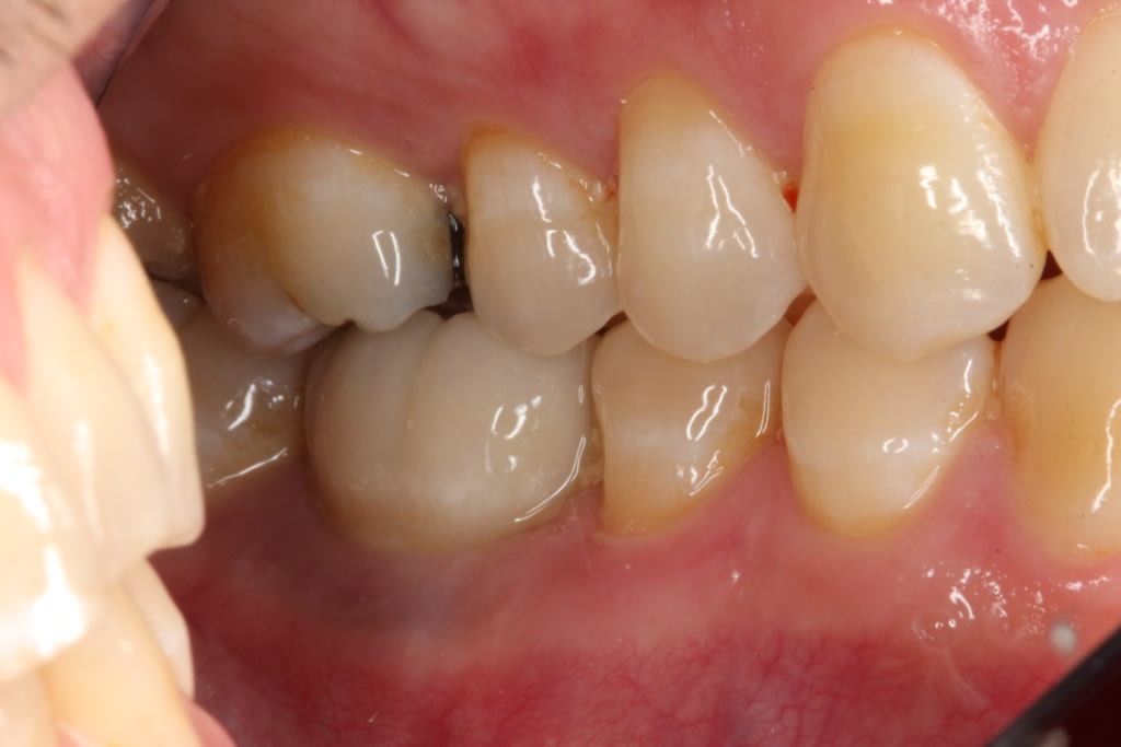 Figure 49