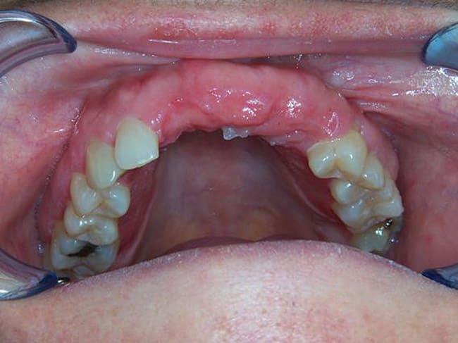 Figure 11