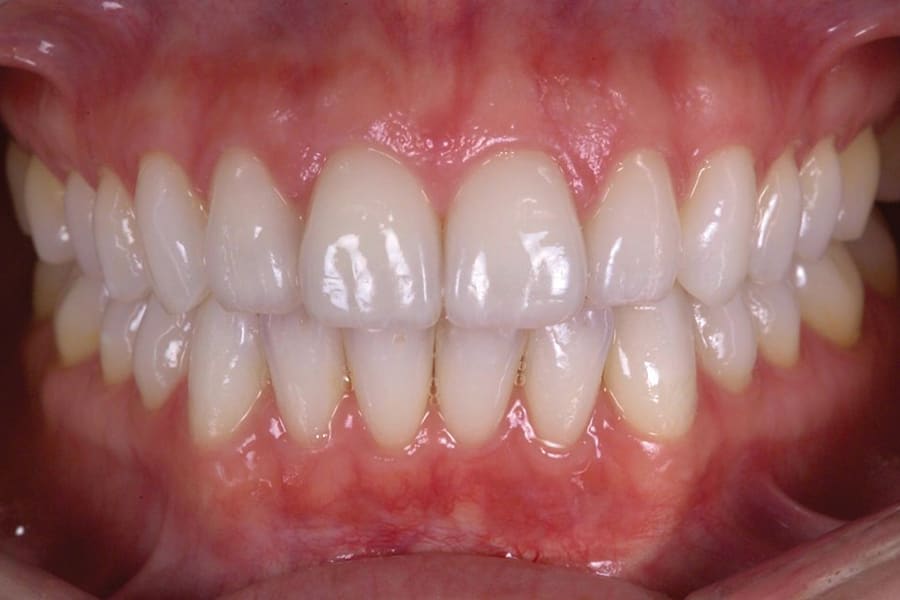 Figure 12