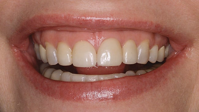 Figure 27