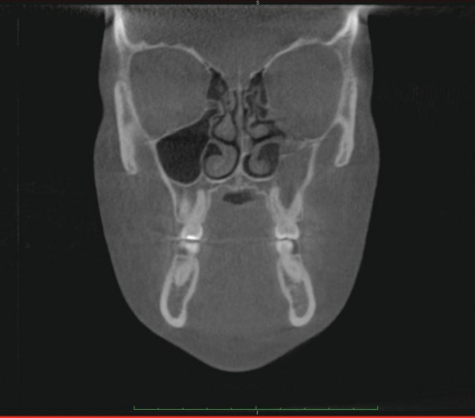 Figure 37