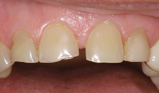 Figure 6d