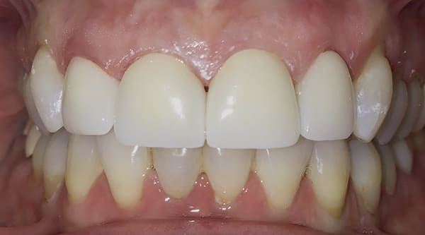 Figure 12