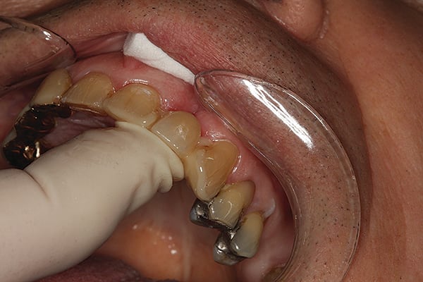 Figure 10