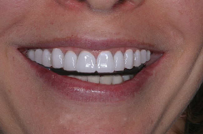 Figure 21