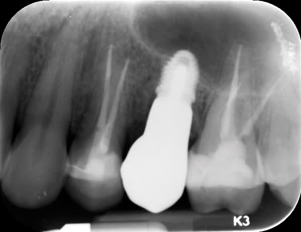 Figure 15