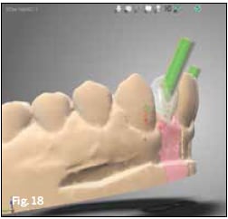 Figure 18