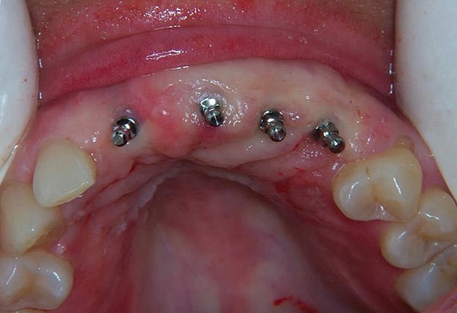 Figure 14